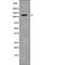 ACK1 antibody, PA5-64733, Invitrogen Antibodies, Western Blot image 