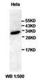 Nucleolar Protein 3 antibody, orb77391, Biorbyt, Western Blot image 