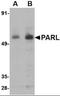 Presenilin Associated Rhomboid Like antibody, orb94384, Biorbyt, Western Blot image 