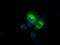Aldehyde Dehydrogenase 3 Family Member A1 antibody, GTX84889, GeneTex, Immunofluorescence image 