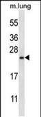 RHEB Like 1 antibody, PA5-48454, Invitrogen Antibodies, Western Blot image 