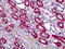 DExH-Box Helicase 9 antibody, 51-690, ProSci, Immunohistochemistry paraffin image 
