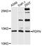 Podoplanin antibody, LS-C334993, Lifespan Biosciences, Western Blot image 