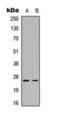 Complement C1q C Chain antibody, orb393228, Biorbyt, Western Blot image 