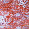 Keratin 14 antibody, LS-C87580, Lifespan Biosciences, Immunohistochemistry frozen image 