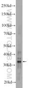 Archaelysin Family Metallopeptidase 1 antibody, 24484-1-AP, Proteintech Group, Western Blot image 