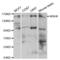 MutS Homolog 6 antibody, abx000936, Abbexa, Western Blot image 