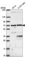 U3 small nucleolar RNA-associated protein 6 homolog antibody, NBP2-55583, Novus Biologicals, Western Blot image 