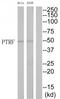 Cavin-1 antibody, TA316311, Origene, Western Blot image 