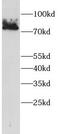 Ecdysoneless Cell Cycle Regulator antibody, FNab10368, FineTest, Western Blot image 