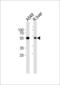 Aldehyde Dehydrogenase 1 Family Member A1 antibody, 61-037, ProSci, Western Blot image 