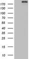 DNA Topoisomerase II Alpha antibody, LS-C789503, Lifespan Biosciences, Western Blot image 