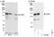 Ubiquitin Specific Peptidase 8 antibody, NBP1-50001, Novus Biologicals, Western Blot image 