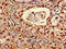 ATP Synthase F1 Subunit Delta antibody, LS-C369289, Lifespan Biosciences, Immunohistochemistry paraffin image 