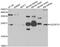 Ubiquinol-Cytochrome C Reductase, Rieske Iron-Sulfur Polypeptide 1 antibody, abx005206, Abbexa, Western Blot image 