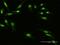 Zinc Finger Protein 668 antibody, H00079759-B01P, Novus Biologicals, Immunocytochemistry image 