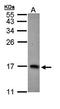6-Pyruvoyltetrahydropterin Synthase antibody, orb69816, Biorbyt, Western Blot image 