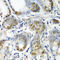 Crystallin Alpha A antibody, A5725, ABclonal Technology, Immunohistochemistry paraffin image 