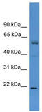 Achaete-Scute Family BHLH Transcription Factor 3 antibody, TA345288, Origene, Western Blot image 