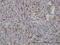 FGR Proto-Oncogene, Src Family Tyrosine Kinase antibody, LS-C133194, Lifespan Biosciences, Immunohistochemistry frozen image 