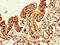 FLI1 antibody, CSB-PA008714LA01HU, Cusabio, Immunohistochemistry paraffin image 