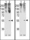 Growth Differentiation Factor 11 antibody, LS-C97989, Lifespan Biosciences, Western Blot image 