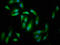 Fermitin Family Member 2 antibody, LS-C672404, Lifespan Biosciences, Immunofluorescence image 
