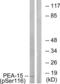 Proliferation And Apoptosis Adaptor Protein 15 antibody, LS-C199429, Lifespan Biosciences, Western Blot image 