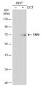 Dopachrome Tautomerase antibody, GTX134445, GeneTex, Western Blot image 