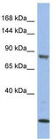 Mitogen-Activated Protein Kinase Kinase Kinase 11 antibody, TA337664, Origene, Western Blot image 