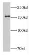 Dispatched RND Transporter Family Member 1 antibody, FNab02398, FineTest, Western Blot image 