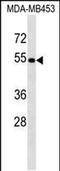 1-Aminocyclopropane-1-Carboxylate Synthase Homolog (Inactive) antibody, PA5-48929, Invitrogen Antibodies, Western Blot image 