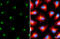 Polypeptide N-Acetylgalactosaminyltransferase 2 antibody, GTX104070, GeneTex, Immunofluorescence image 