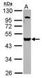 Vacuolar Protein Sorting 4 Homolog B antibody, GTX115249, GeneTex, Western Blot image 