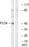Phospholipase D Family Member 4 antibody, abx014716, Abbexa, Western Blot image 