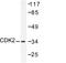 Cyclin Dependent Kinase 2 antibody, LS-C175952, Lifespan Biosciences, Western Blot image 