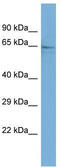 Polypeptide N-Acetylgalactosaminyltransferase 9 antibody, TA346813, Origene, Western Blot image 