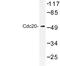 Cell Division Cycle 20 antibody, LS-C176863, Lifespan Biosciences, Western Blot image 