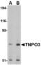 Transportin 3 antibody, TA306572, Origene, Western Blot image 