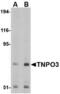 Transportin 3 antibody, TA306572, Origene, Western Blot image 