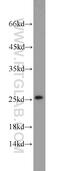 Secretion Associated Ras Related GTPase 1B antibody, 22292-1-AP, Proteintech Group, Western Blot image 