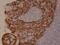 Keratin 5 antibody, M00398-4, Boster Biological Technology, Immunohistochemistry paraffin image 