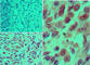 Component Of Inhibitor Of Nuclear Factor Kappa B Kinase Complex antibody, IM4761, ECM Biosciences, Immunohistochemistry paraffin image 