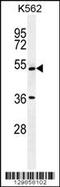 UDP-N-Acetylglucosamine Pyrophosphorylase 1 Like 1 antibody, 56-107, ProSci, Western Blot image 