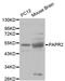 Parkin RBR E3 Ubiquitin Protein Ligase antibody, MBS128027, MyBioSource, Western Blot image 
