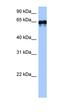 Transglutaminase 6 antibody, orb325450, Biorbyt, Western Blot image 