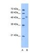 Zinc Finger Protein 763 antibody, NBP1-79358, Novus Biologicals, Western Blot image 