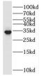 RNA Polymerase II Subunit C antibody, FNab06621, FineTest, Western Blot image 