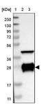 DnaJ Heat Shock Protein Family (Hsp40) Member C5 antibody, PA5-52975, Invitrogen Antibodies, Western Blot image 