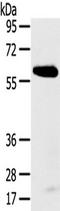 Spermatogenesis Associated 18 antibody, TA351747, Origene, Western Blot image 